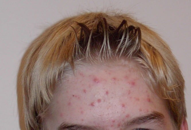 Red Spots