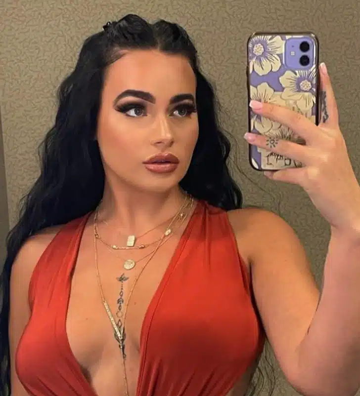 Lip Fillers
