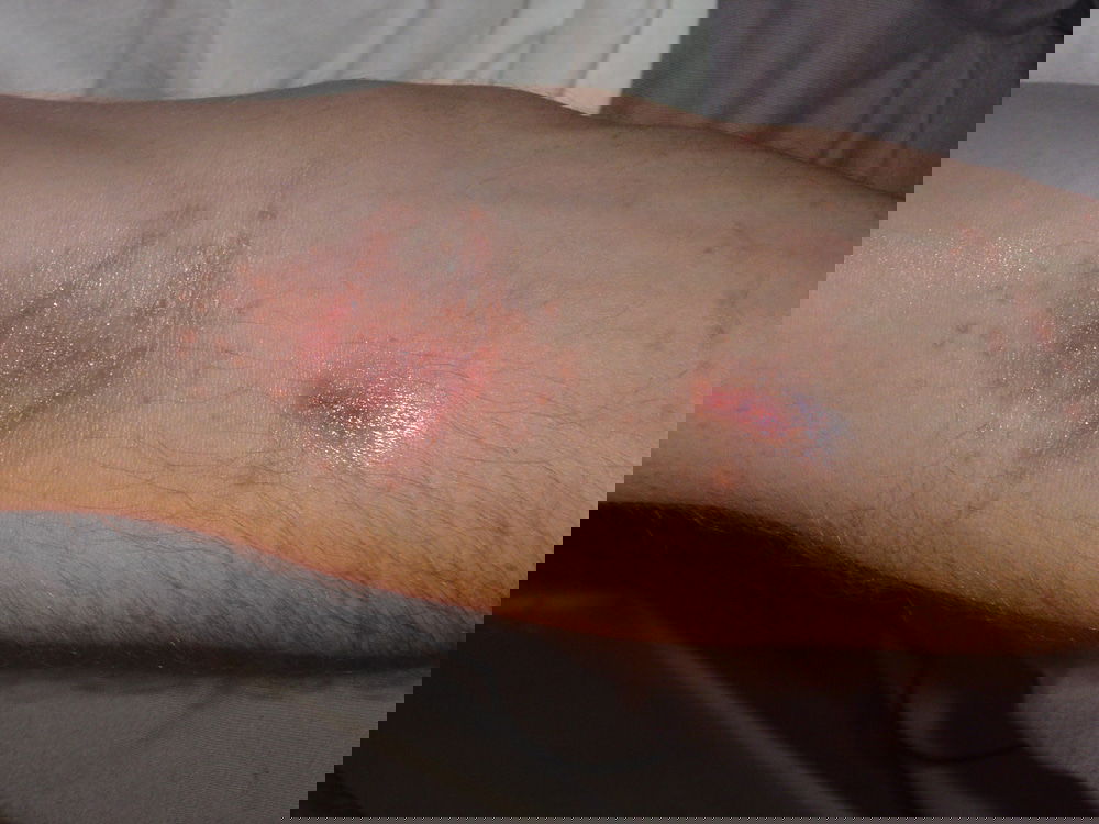 Red Spots