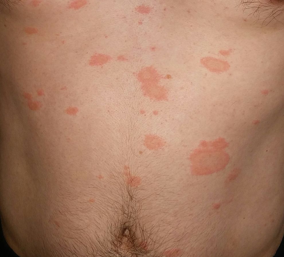 Red Spots