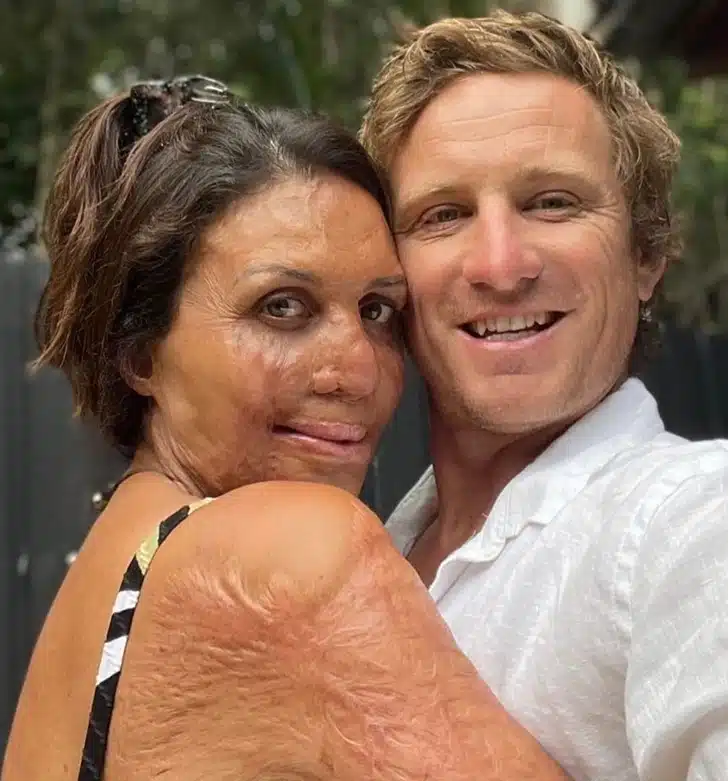 Turia Pitt