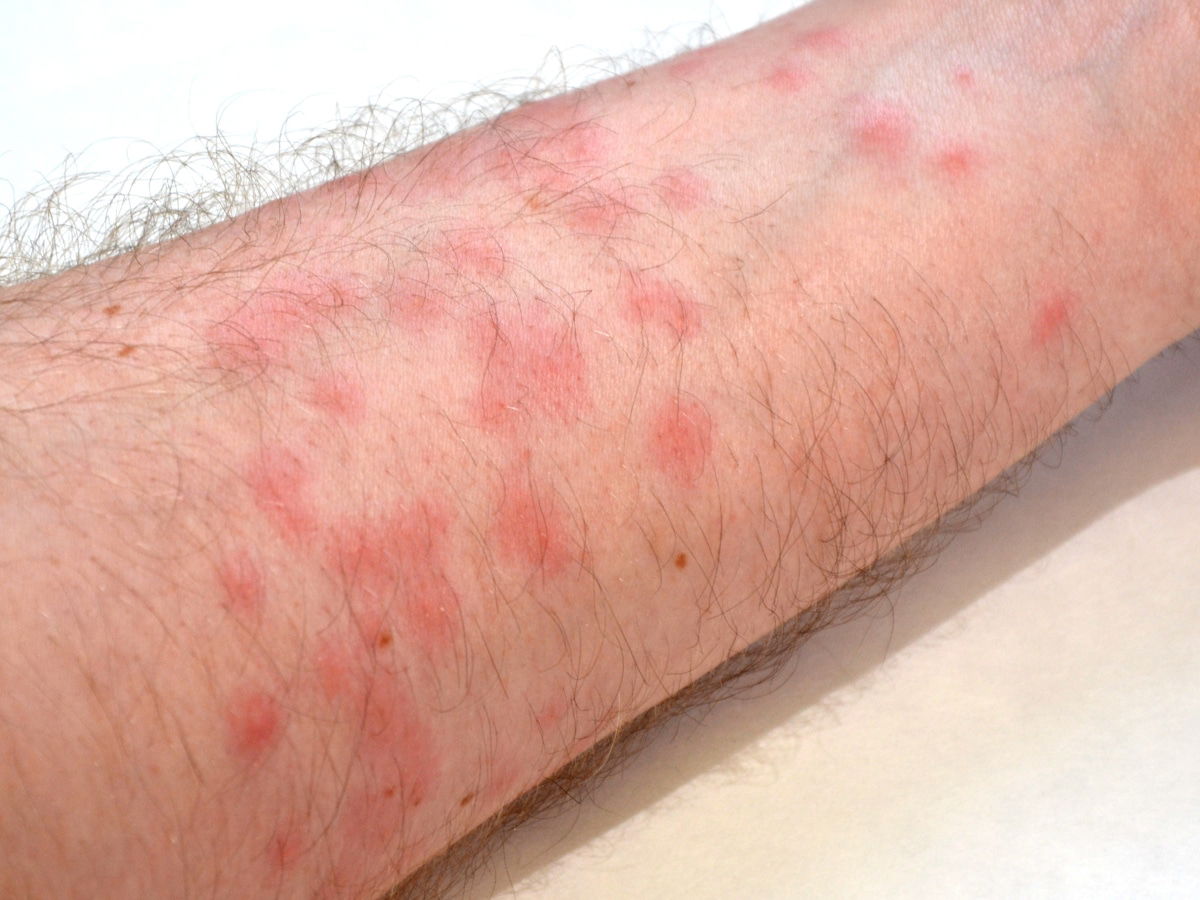 Red Spots