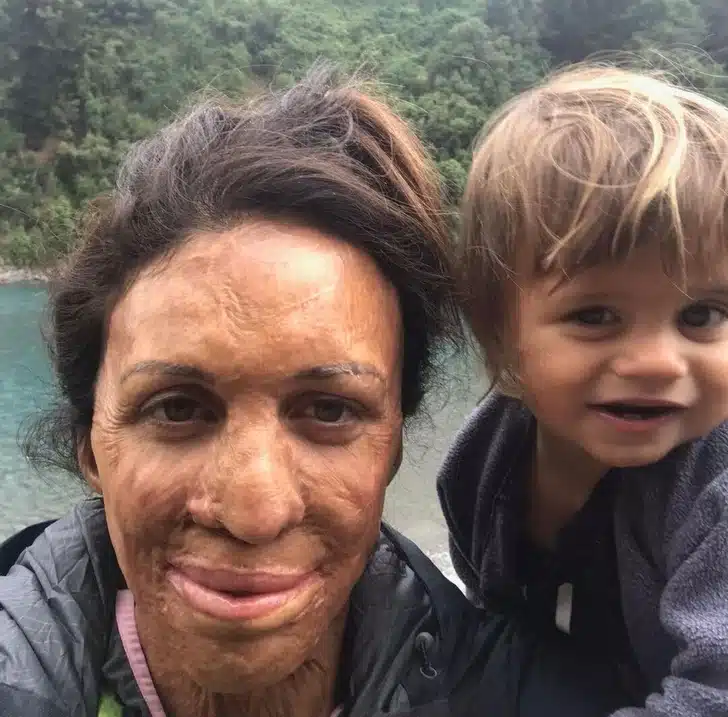 Turia Pitt