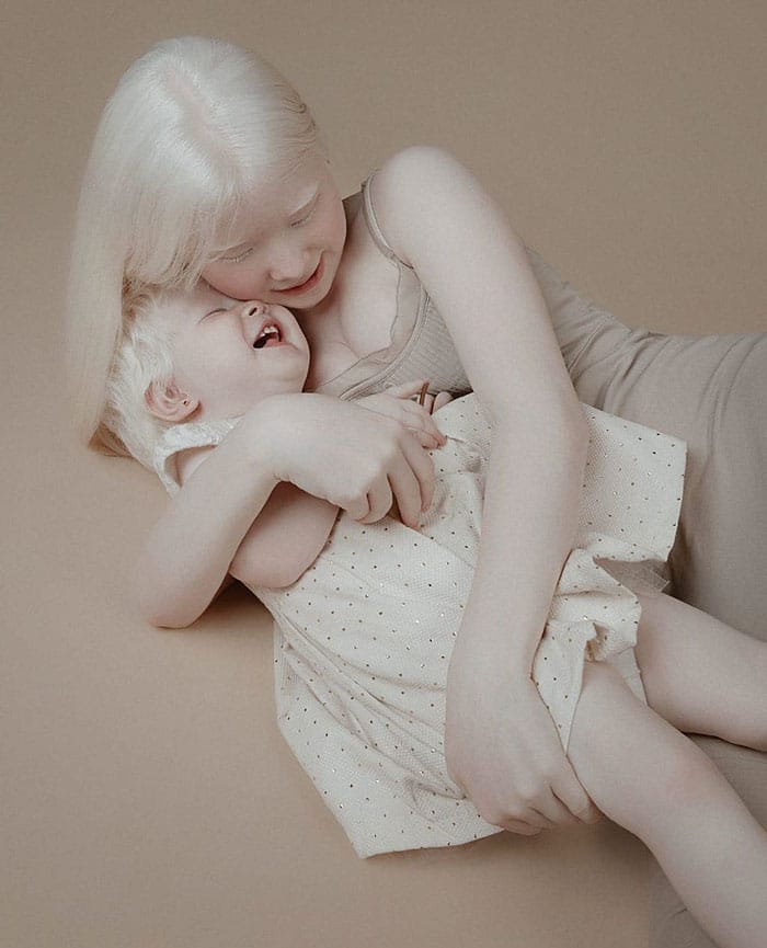 Albino Sisters