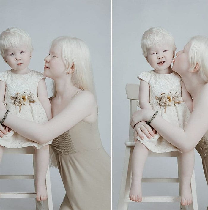 Albino Sisters