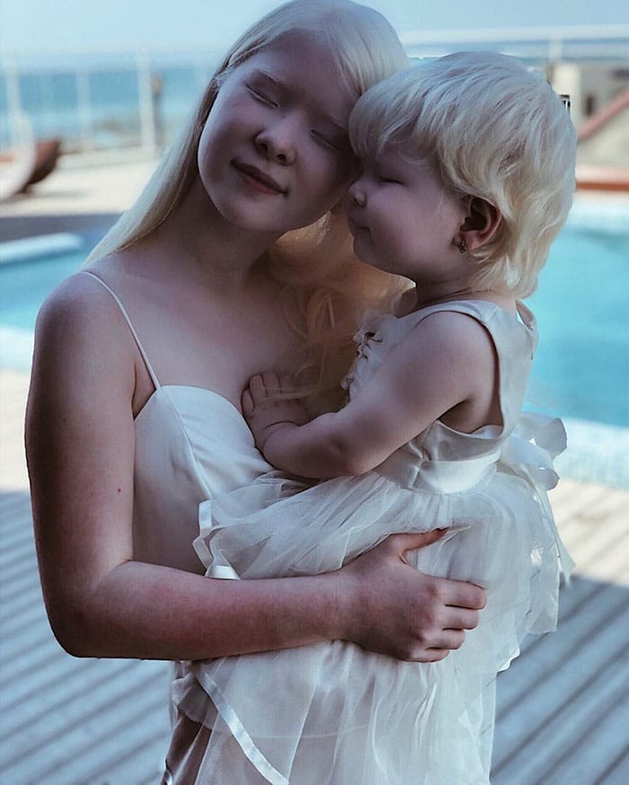 Albino Sisters