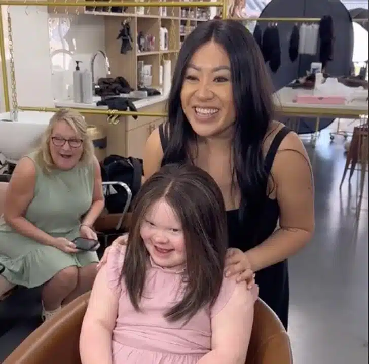 Girl with Alopecia