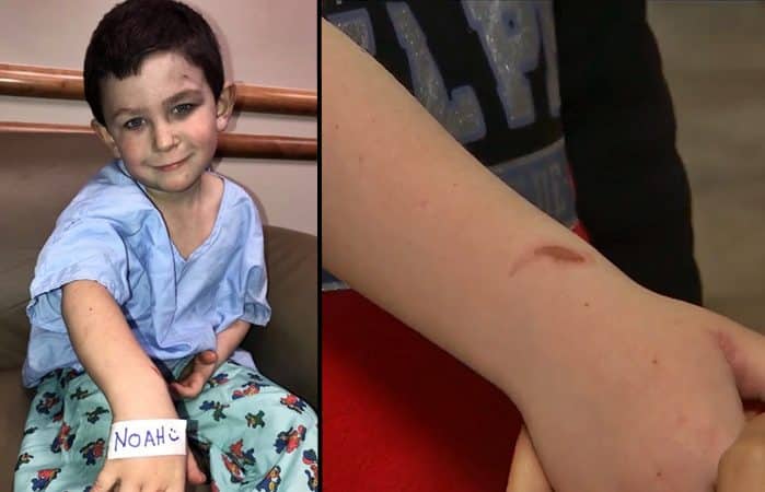 5-year-old boy