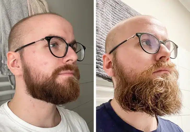 Beards