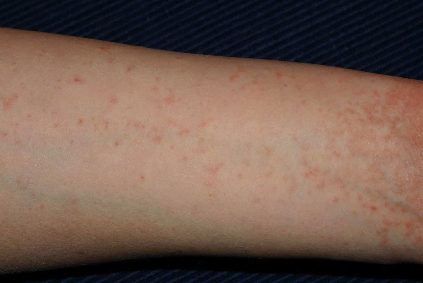 Diseases