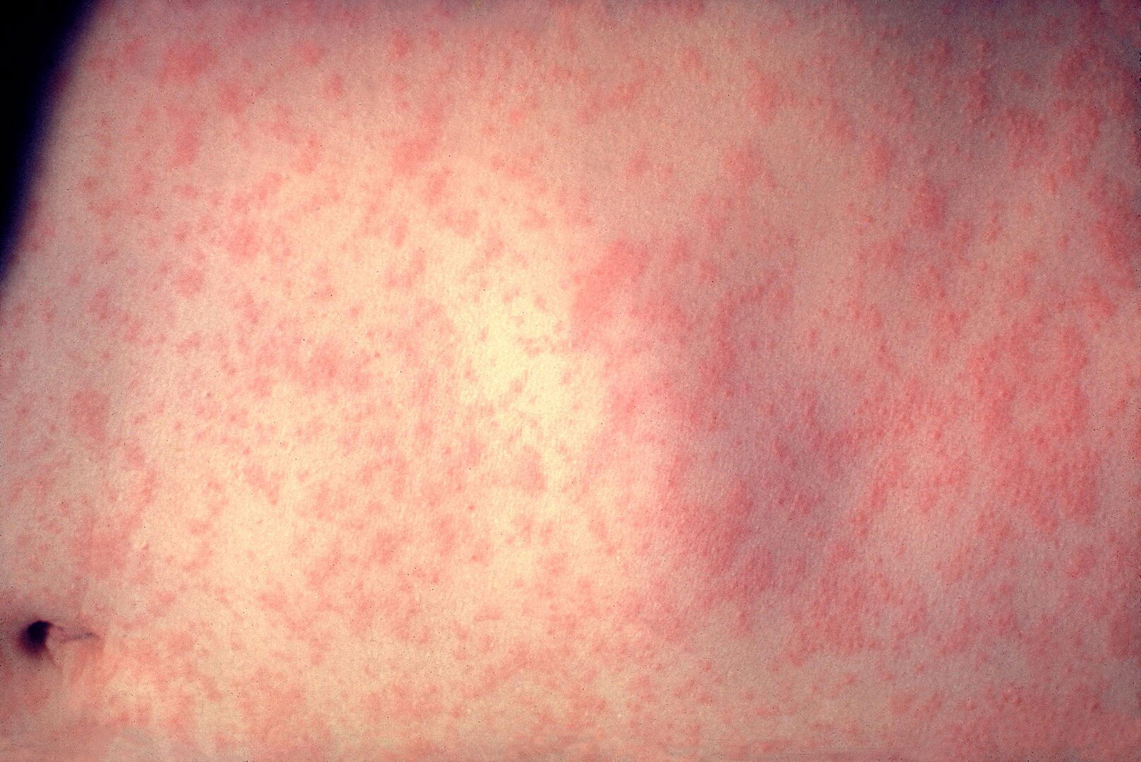 Diseases
