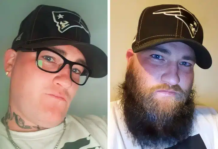 Beards