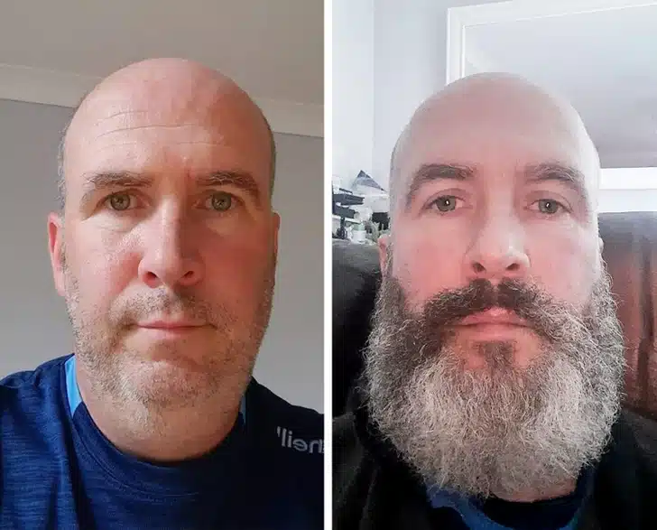 Beards
