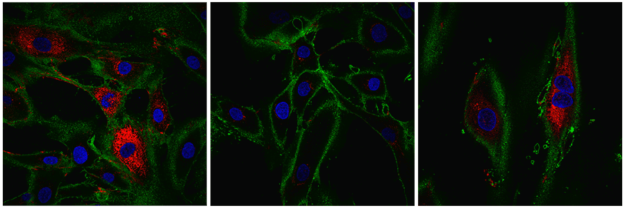 Skin Cells